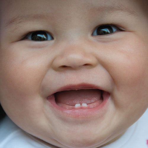 Teeth, glorious teeth!